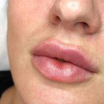 Яна Шутенко , Бердянськ Фото - 5