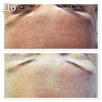 Фото с портфолио VIT