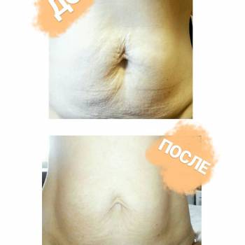 Фото с портфолио VIT