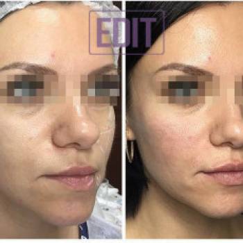 EDIT beauty, Киев Фото - 5