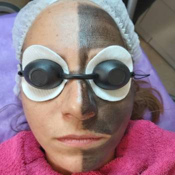 ASA LASER COSMETIC, Киев Фото - 2