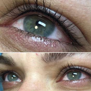 Межресничка и маленькая стрелка