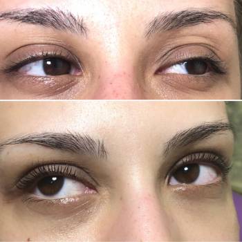 Ламинирование и оздоровление ресниц