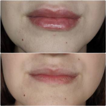 Катерина Зацерковна, Вінниця Фото - 10