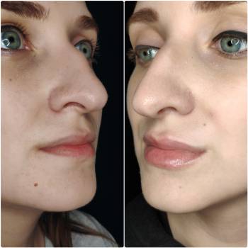 Катерина Зацерковна, Вінниця Фото - 9