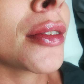 Анна Железная, Сумы Фото - 6