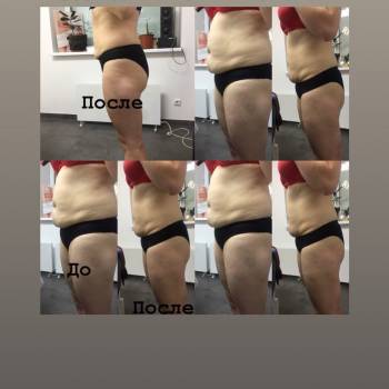 Ялливел, Ирпень Фото - 6