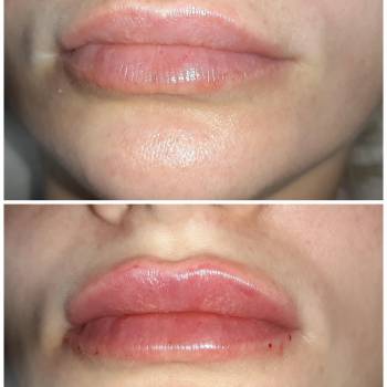 Ирина Зубко, Киев Фото - 16