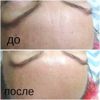 Олена Шаповал, Дніпро Фото - 12