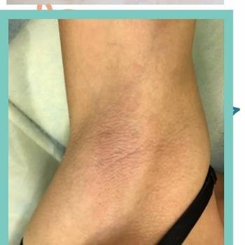 Фото с портфолио Людмила 