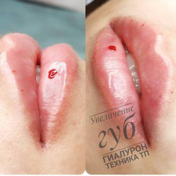 Ольга Булгакова Булгакова, Кропивницький Фото - 6