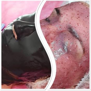 Виктория , Вишнёвое Фото - 5