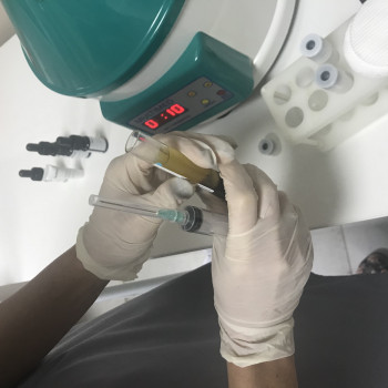 Обработка крови