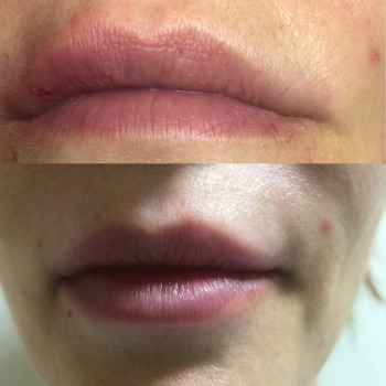 Фото с портфолио Алла Грищук