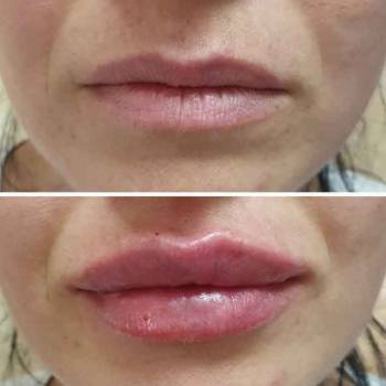 Фото с портфолио Екатерина Биткова 