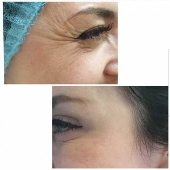 Фото с портфолио Екатерина Биткова 