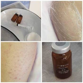 Фото с портфолио Екатерина Биткова 