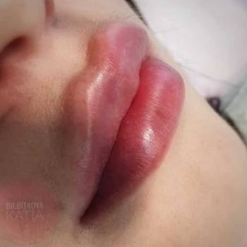 Фото с портфолио Екатерина Биткова 