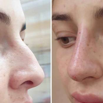 Фото с портфолио Екатерина Биткова 