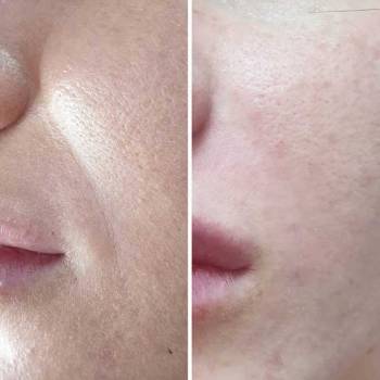 Фото с портфолио Екатерина Биткова 