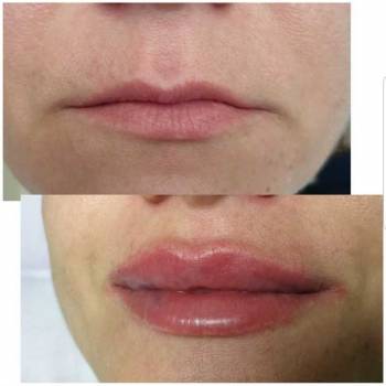 Фото с портфолио Екатерина Биткова 