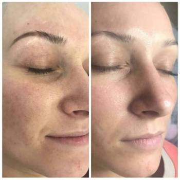 ROYALLOOK, Ізмаїл Фото - 8