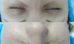  Косметолог Ирина Черкаси