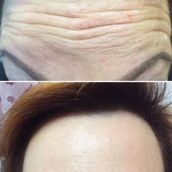 Оксана Глейзер , Александрия Фото - 5