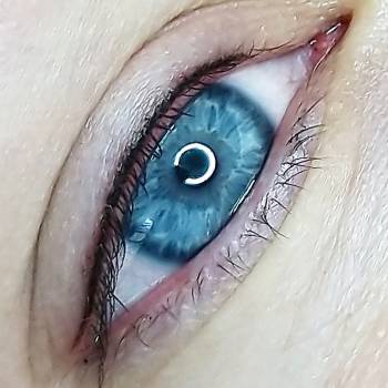 Межресничка