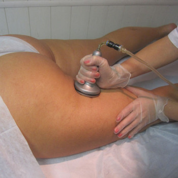 Вакуумный массаж
                    Косметолог Наталия Галуза Чернігів