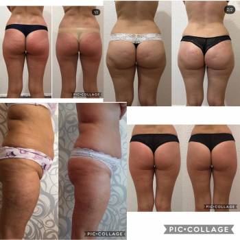 Юлія Сіренко, Полтава Фото - 10