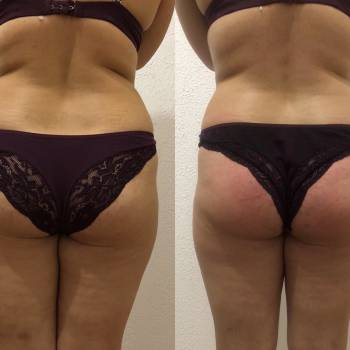 Юлія Сіренко, Полтава Фото - 11