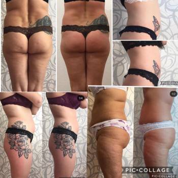 Юлія Сіренко, Полтава Фото - 13