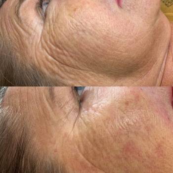 Этуаль, Київ Фото - 33