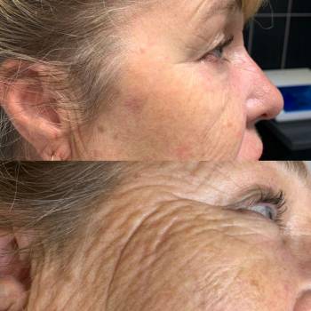 Этуаль, Київ Фото - 34