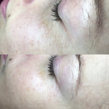 Механическая чистка лица
                    Косметолог Оксана Оринник Харьков