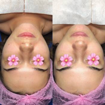 Освітлення, вирівнювання тонух