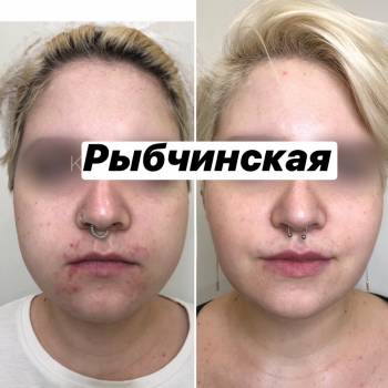 Наталія Рибчинська, Київ Фото - 52