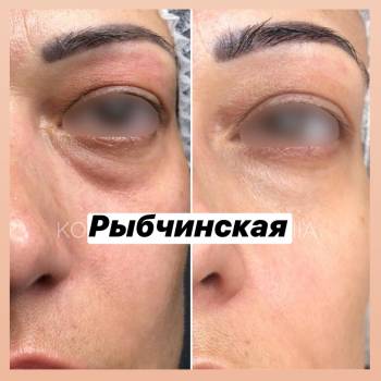 Наталія Рибчинська, Київ Фото - 56