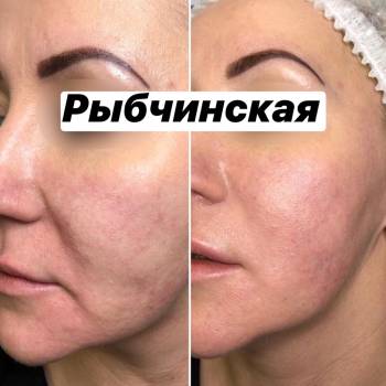 Наталія Рибчинська, Київ Фото - 58