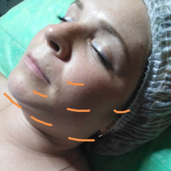 фото перед началом курса