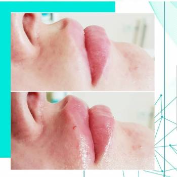 Essence of Beauty, Винница Фото - 20