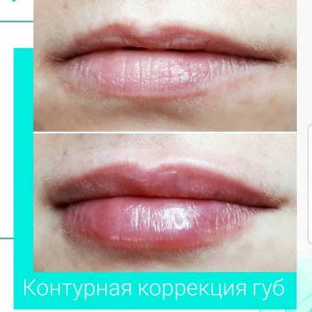 Essence of Beauty, Винница Фото - 22