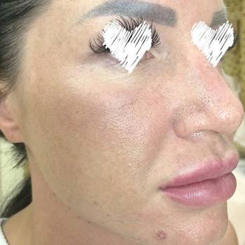 Алькор, Вінниця Фото - 67