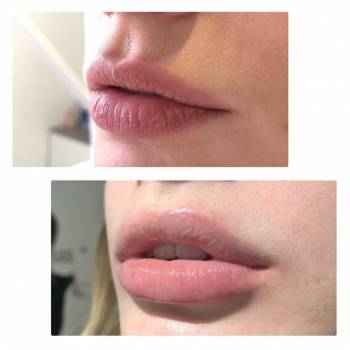 Алькор, Вінниця Фото - 9