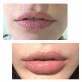 Алькор, Вінниця Фото - 7