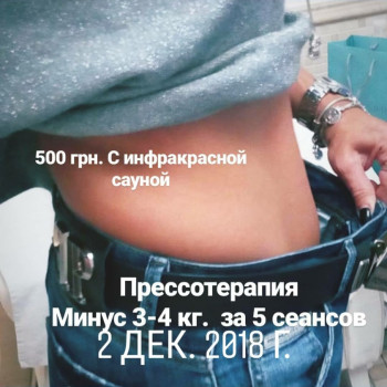 Прессотерапия