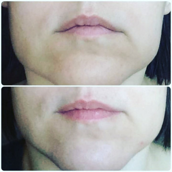 Массаж лица. Миофасциальный
                    Массажист Яна Киев