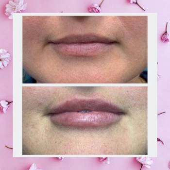 ASTORIA, Фастов Фото - 16