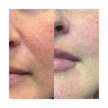 ASTORIA, Фастов Фото - 19